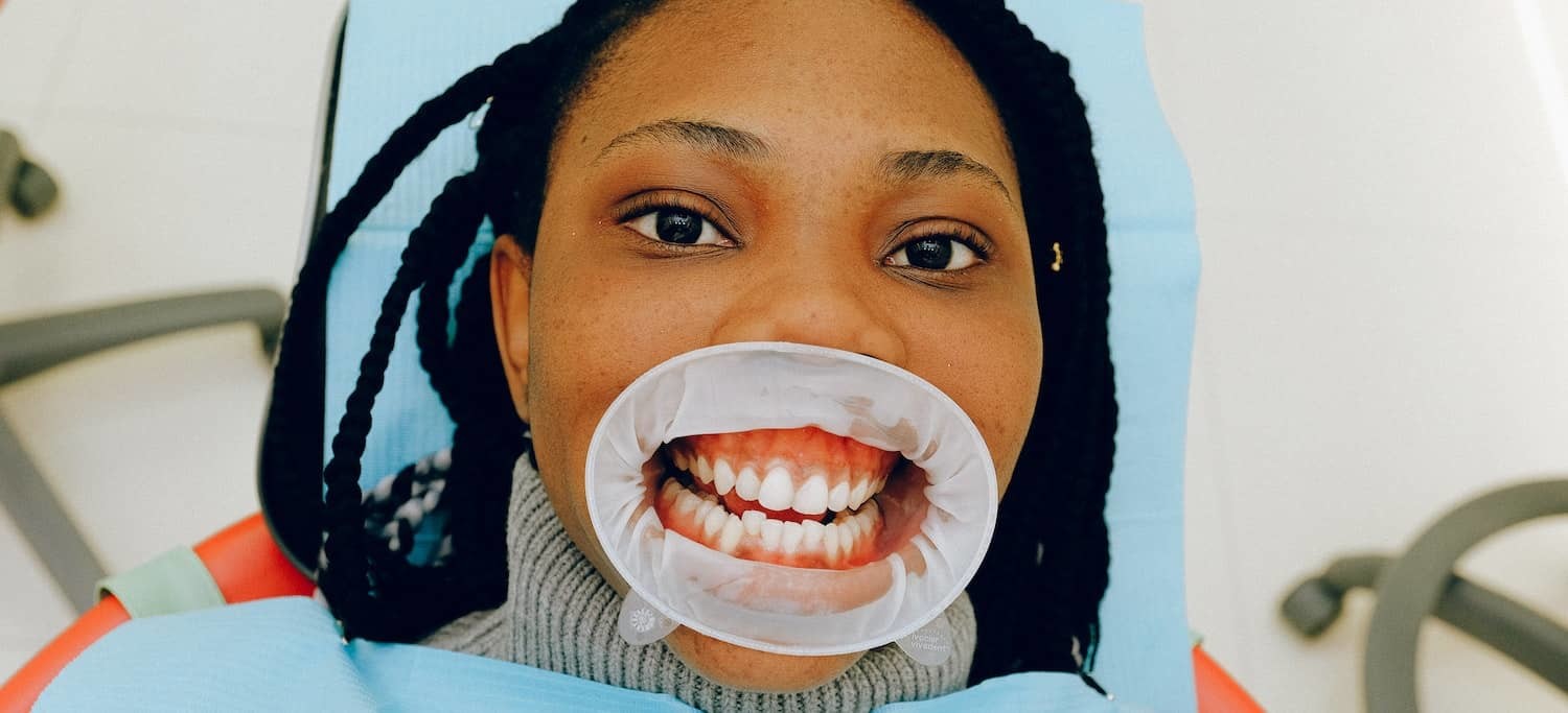 Gingival Cold Test - Woman with Dental Cheek Retractor