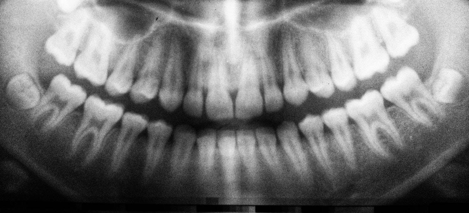 Picture of a Dental X-Ray - Guided and Structured Discovery Questions for Patient Case Studies