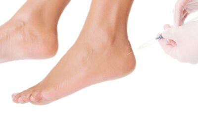 New Injection Techniques for Treating Chronic Foot Pain
