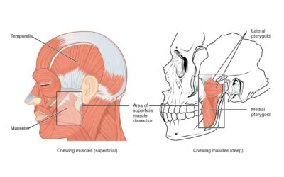 How to Measure Orofacial Pain With a Muscle Tenderness Exam