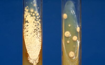 How to Perform an Agar Slant Culture Test for Fungal Infections