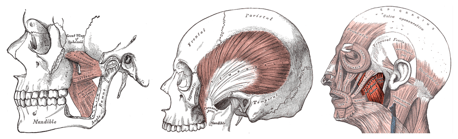 Left medial and lateral pterygoid muscles, left temporalis muscle, and Left masseter muscle