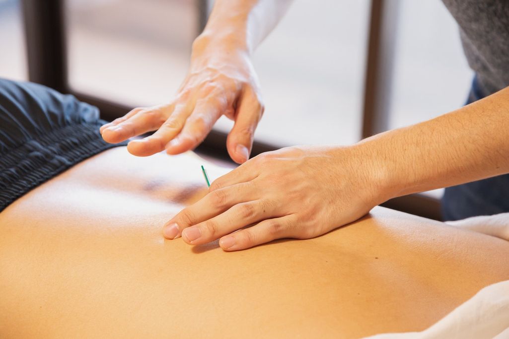 Does acupuncture really work?